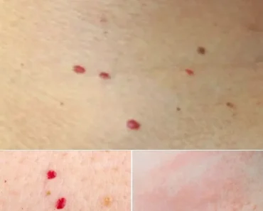 Red dots on your skin: Causes and what they could mean – vtknews.online
