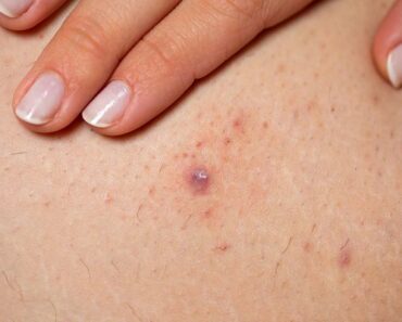 HT10. These are the signs that it’s no longer just sweat… See more – Daily News