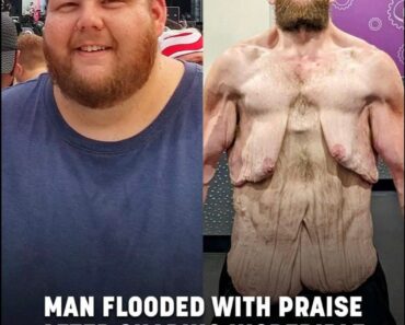Internet praises man for 360lb weight loss –
