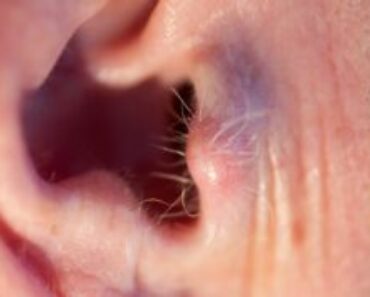 Did you know that if your ear hairs grow, it is because your body is