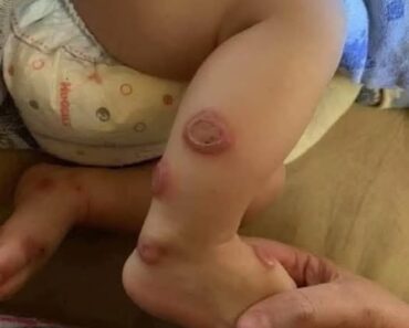 What’s wrong with this child? Possible case of severe skin infection