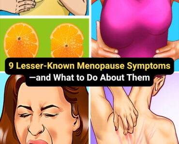 9 Lesser-Known Menopause Symptoms—and What to Do About Them