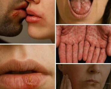 ✍️Don’t Underestimate It: Recognizing the Early Signs of Oral Can See More – Daily News