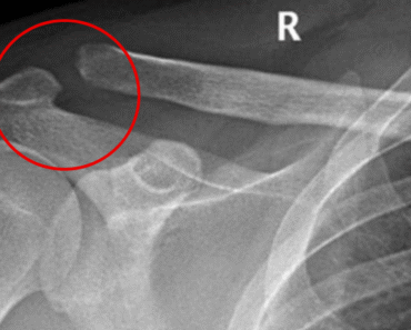 This product poses a risk to bones and many people consume it daily.
