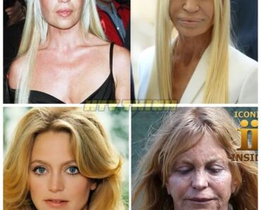 25 Celebrities Who Aged So Badly You Won’t Believe What They Look Like Now—Some Are Completely Unrecognizable and the Internet Can’t Stop Talking About ItThey once graced magazine covers and red carpets, but time hasn’t been kind—and their shocking transformations will leave you stunned