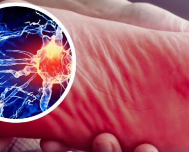 How to treat nerve pain in the foot, toes & legs