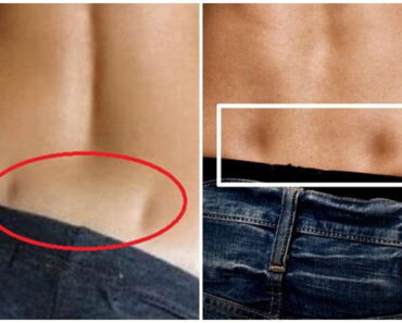 Do you have two holes in your lower back? Then see what it means