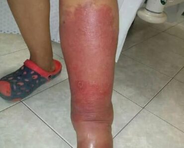 HT13. Health Warning Signs on Your Feet You Should Never Ignore See More