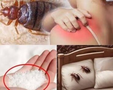 Bedbugs: Simple Methods to Eradicate Them from Your Home – Daily News