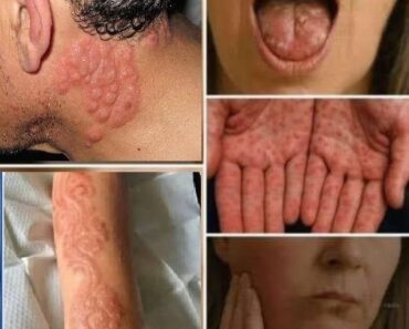 HT10. Symptoms You Should Never Ignore: () What They Might Be Telling You See More