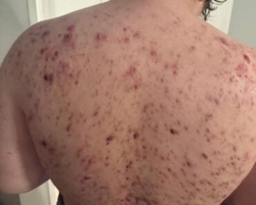 These are the consequences of sleeping with the…See more – readtime.store