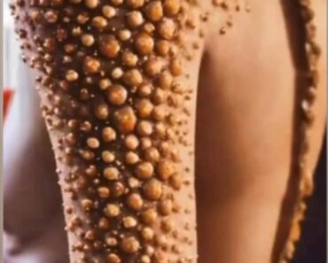 10 Signs Showing Something Is Wrong in Your Body