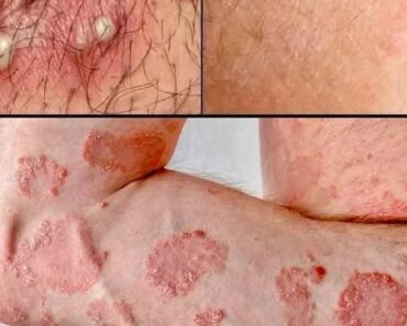 These are the signs that he is cr… See more – NEWTODAYS.COM