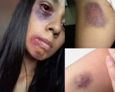 Young woman dies at the hands of her… See more