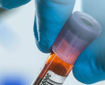 Doctors reveal the one bl00d type which has the highest risk of getting stomach canc3r