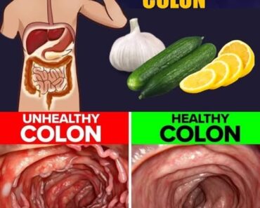 Why Your Gut Deserves More Love Than You Think