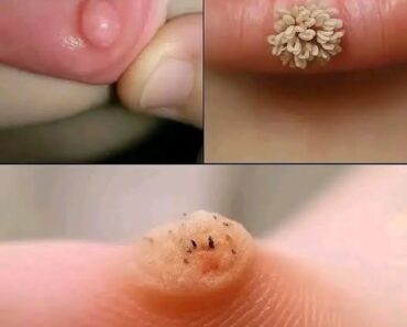 These are the first signs of an enf… See more