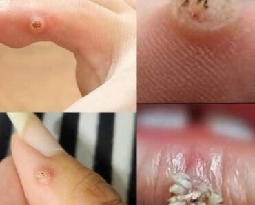 To BE VERY CAREFUL . If you get this, you are infected with ….