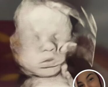 Pregnant Mom Prays For Her Baby’s Health, Stunned When She Looks Closer At Ultrasound
