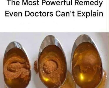 Cinnamon and Honey: The Most Powerful Remedy Even Doctors Can’t Explain