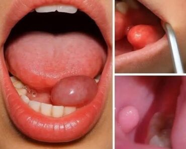 HT7. These are the first symptoms of a… – NEWTODAYS.COM HT7. These are the first symptoms of a… – NEWTODAYS.COM