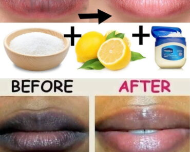 Rub This on Your Lips: I Got Super Soft, Pink Lips With No Pigmentation—Thanks to This One Slice!