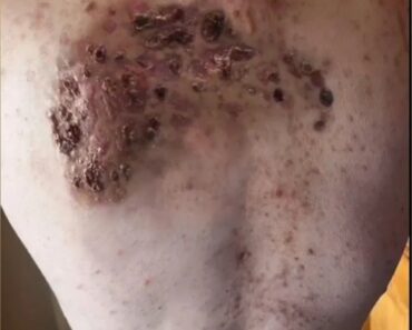 Description of the Condition: