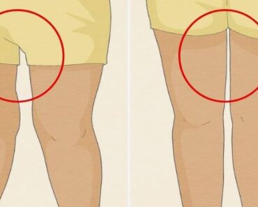 The gap between a woman’s legs can reveal that she is…