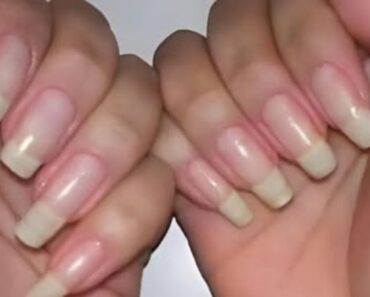 What It Really Means If Your Fingernails Grow Fast