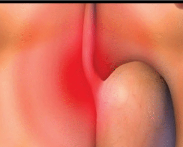 7 signs of late stage stomach can.cer