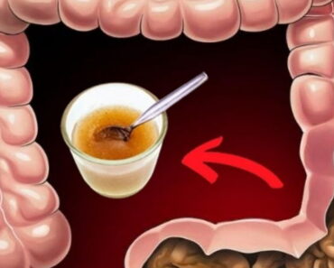 Drink this every morning to flush out toxic fats stored for years!