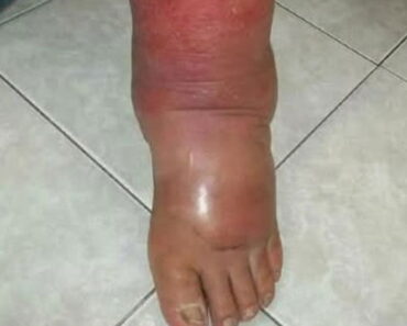 Signs on your FEET