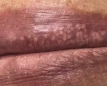 You should be worried if your lips show these signs