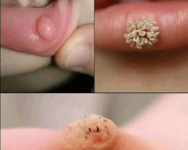 These are the first signs of an enf… See more – Daily News