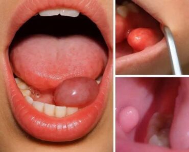 These are the first symptoms of a…See more – Daily News