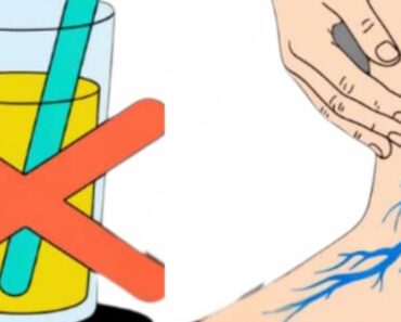 Top 5 Drinks That Ha.rm Circulation, Clog Your Arteries & Veins