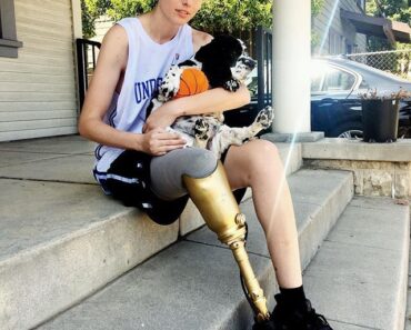 HT10. Her legs are amputated after using a common household product See More – Daily News