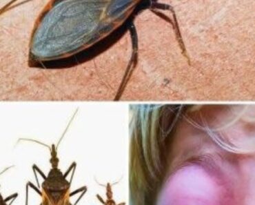 If you ever get stung, DON’T IGNORE the bite—it can be quite serious. Here’s what they are and what you should do. Check 1st comment