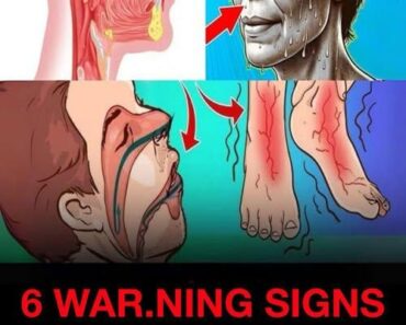 Diabetes Doesn’t Always Look Like You Think: 6 Silent Signs You Shouldn’t Ignore—Even If You’re Slim