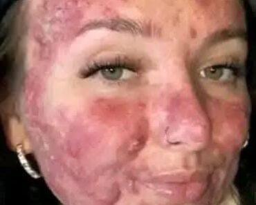 His body was itchy, he thought it was an allergy, they diagnosed him with ca…see more