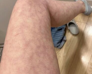 These are the consequences of sleeping with the… See more These are the consequences of sleeping with the… See more