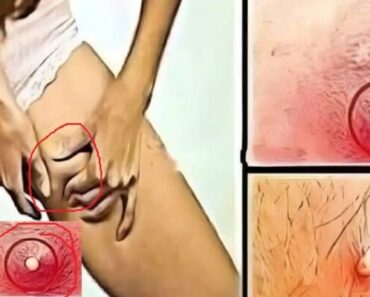 HT10. These are the signs that he is cr… See more – Daily News HT10. These are the signs that he is cr… See more – Daily News