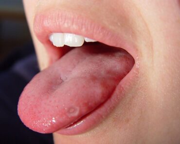 HT10. These are the consequences of eating cr… See more – Daily News