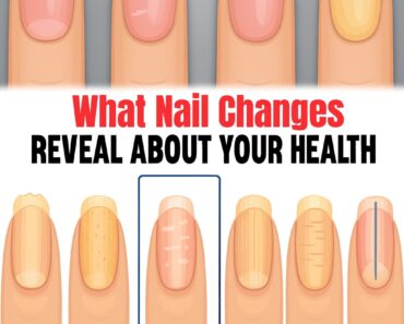 Think your nails are just for beauty? Look closer — those small changes might mean more than you realize