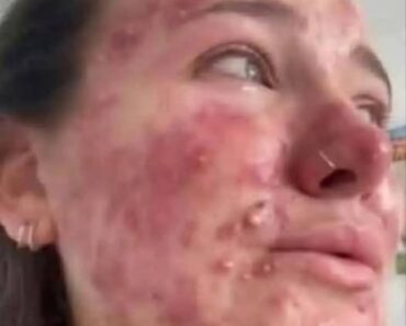 These are the consequences of sleeping with…See more