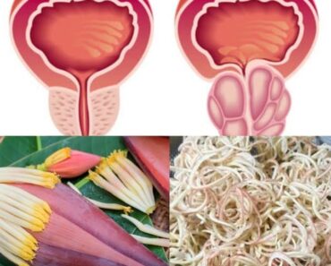 Banana Flower: A Natural Remedy for Prostate Health and Improved Urine Flow