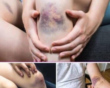 The Best Hospitals in the World for Exceptional Treatment and Therapy