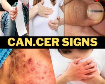 14 Visible Signs Of Can.cer Most Women Ignore