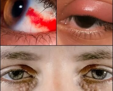  BEWARE! Signs in your Eyes that indicate he is cr… See more