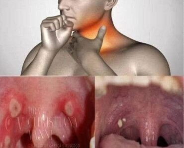 If You Have These 9 Symptoms, Get An HIV Test Immediately If You Have These 9 Symptoms, Get An HIV Test Immediately